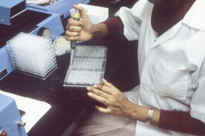 can elisa test for hiv be trusted